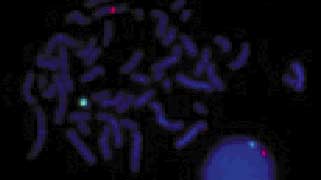 vysis-cep-x-spectrumorange-y-spectrumgreen-direct-labeled-fluorescent-dna-probe-kit-without-control-slides-hybridization-normal-male