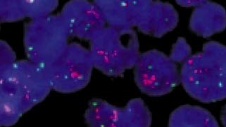 PathVysion HER-2 DNA Hybridization Normal