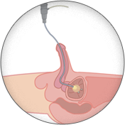 Urovysion image